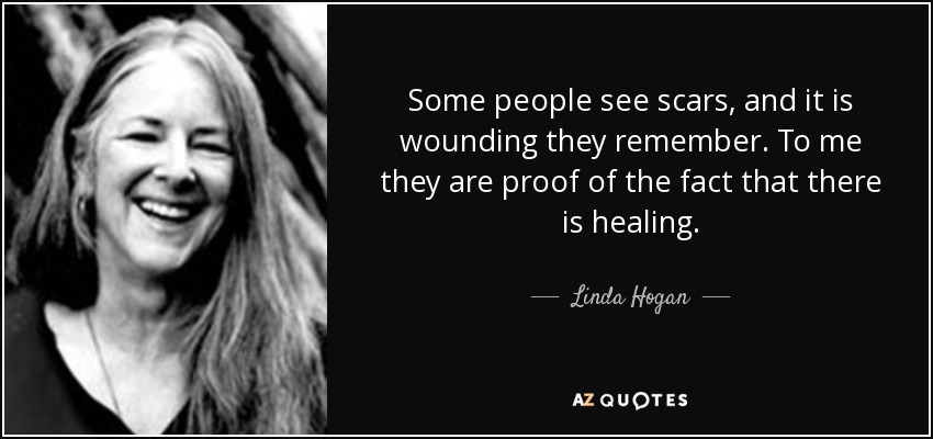 Linda Hogan quote: Some people see scars, and it is wounding they