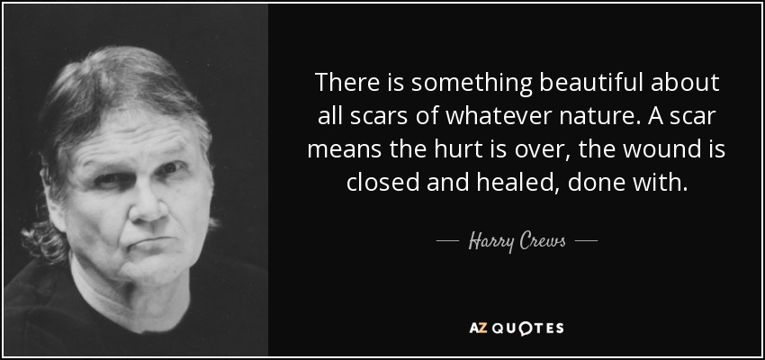 There is something beautiful about all scars of whatever nature. A scar means the hurt is over, the wound is closed and healed, done with. - Harry Crews